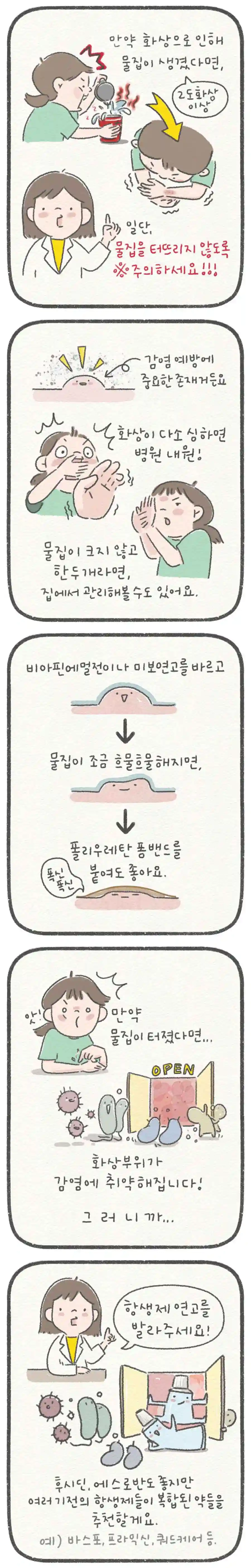 화상입었을때